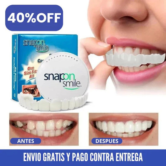 Carillas Dentales Snapon Smile 🦷✨