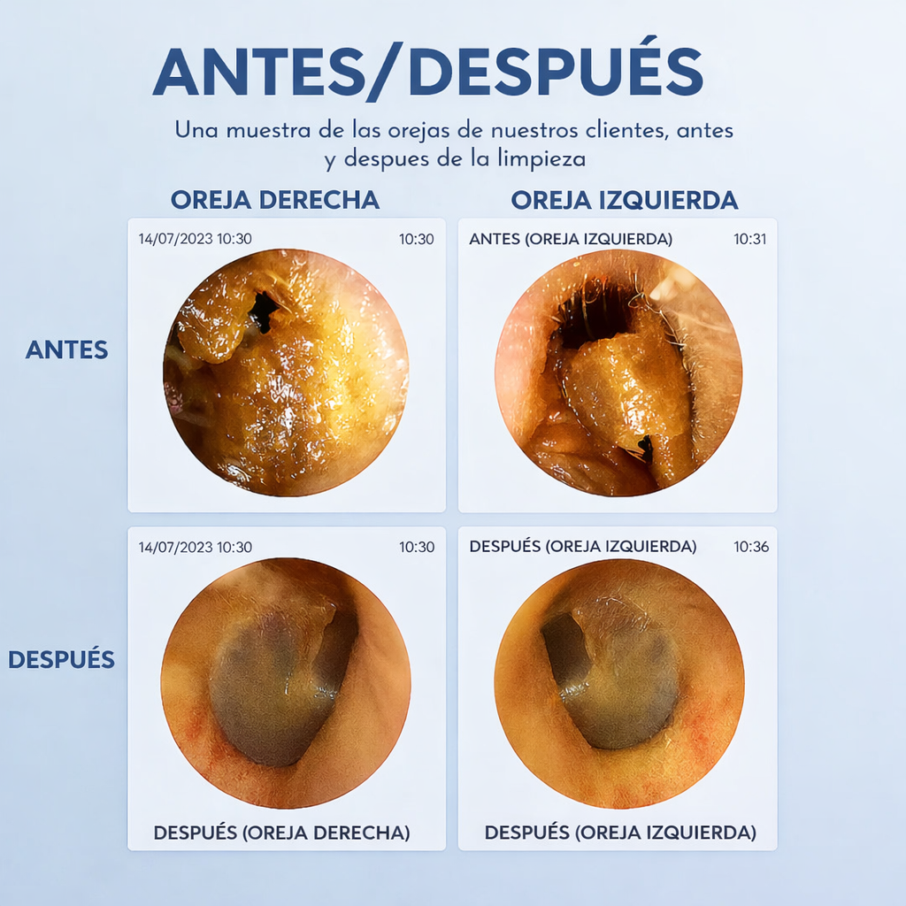 WaxClean™ - Limpieza de oídos inteligente con tecnología avanzada + 7 PZ ACERO INOXIDABLE